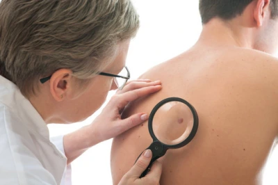 Dermatologista especialista em pele
