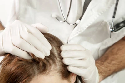 Dermatologista especialista em queda de cabelo