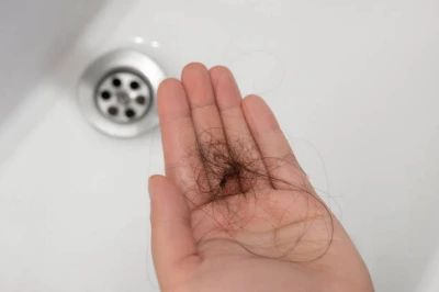 Dermatologista especialista em queda de cabelo na Anália Franco