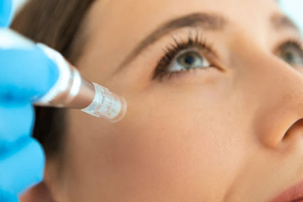 Dermatologista especializada em melasma na Anália Franco