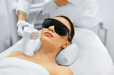 Tratamento de melasma com laser valor